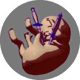 Entwurf der Puppe des ermordeten Neugeborenen; Achim Bahr, 3D (2005)